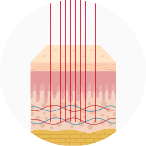 CICU Fractional